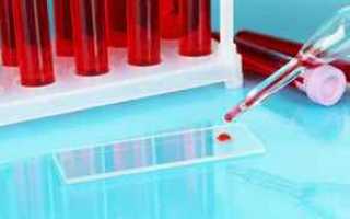 Свертываемость крови при беременности: почему так важен этот показатель для здоровья